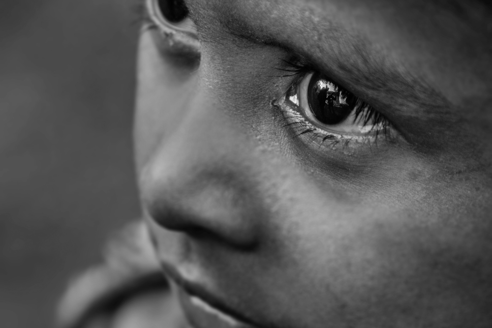 salvata la vista a un bambino di 8 anni